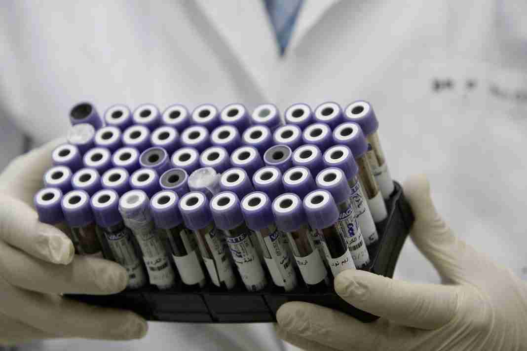 La ricercatrice Ramona Bella sarà festeggiata al comune di Taurianova